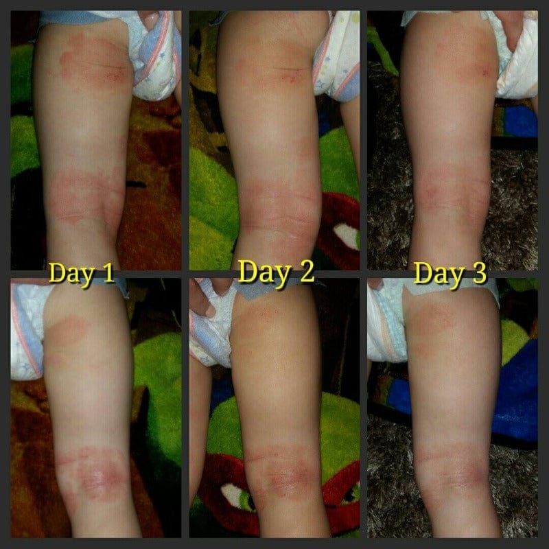 Emu Joy Soothe my skin results