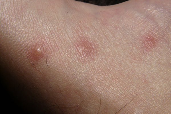 person's skin condition