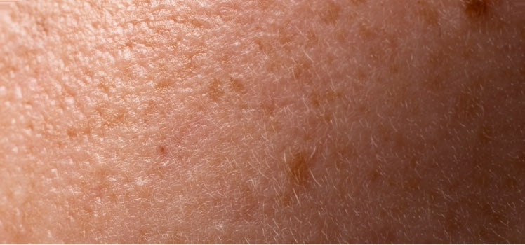 Extreme close-up of dry, textured skin with visible pores and fine hairs