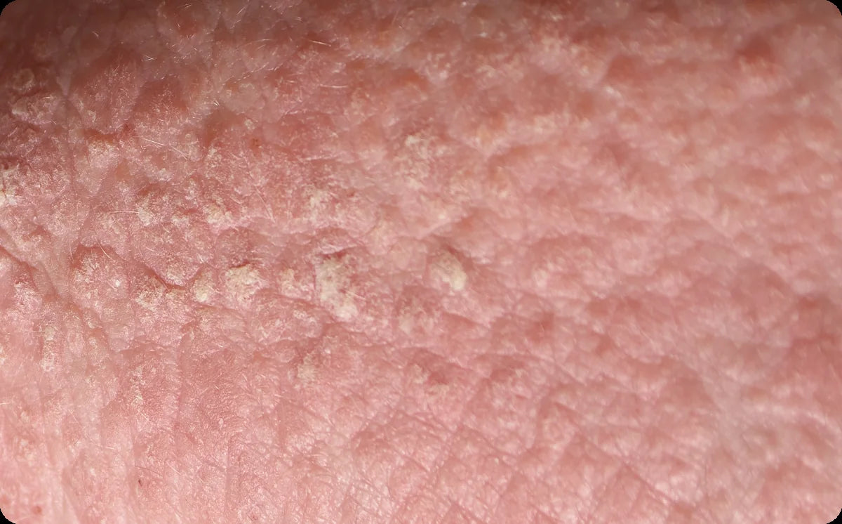 Close-up of dry, rough skin texture