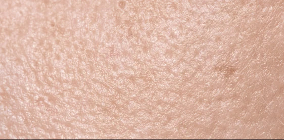 Rough, overworked hands with dry callused skin